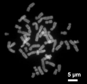 Chromosomen des Menschen unter dem Fluoreszenzmikroskop. (Bild von Steffen Dietzel, CC BY-SA 3.0)